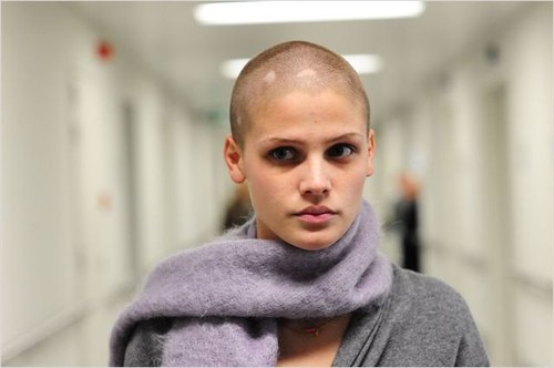 Die Folgen der Chemotherapie bleiben weitgehend auf den Verlust der Haarpracht reduziert